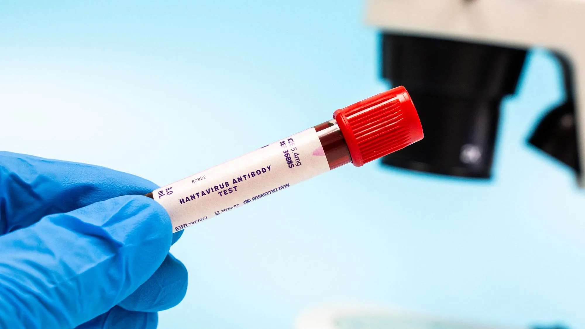 QU’EST-CE QUE LE PROTOCOLE MÉNINGITE DÉSORMAIS UTILISÉ POUR ÉTABLIR LES CAS CONTACT DU HANTAVIRUS ?