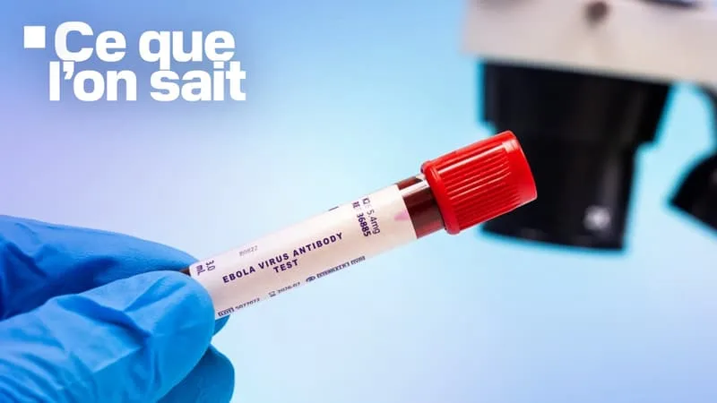 MISSION HUMANITAIRE EN RDC, ISOLEMENT STRICT… CE QUE L’ON SAIT DU PREMIER CAS D’EBOLA DÉTECTÉ EN FRANCE CHEZ UN MÉDECIN