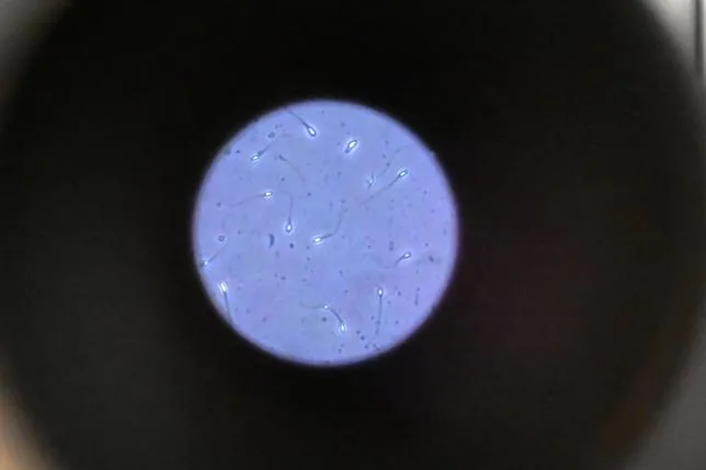 PREMIÈRE MONDIALE : UN PATIENT PRODUIT DU SPERME À PARTIR D’UN TISSU TESTICULAIRE CRYOCONSERVÉ