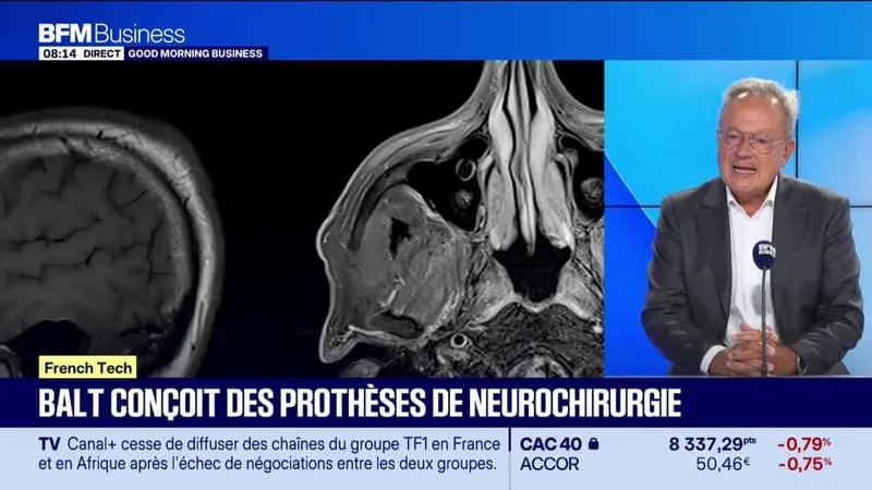 BALT DÉVELOPPE DES DISPOSITIFS ENDOVASCULAIRES, « FINS COMME DES CHEVEUX »
