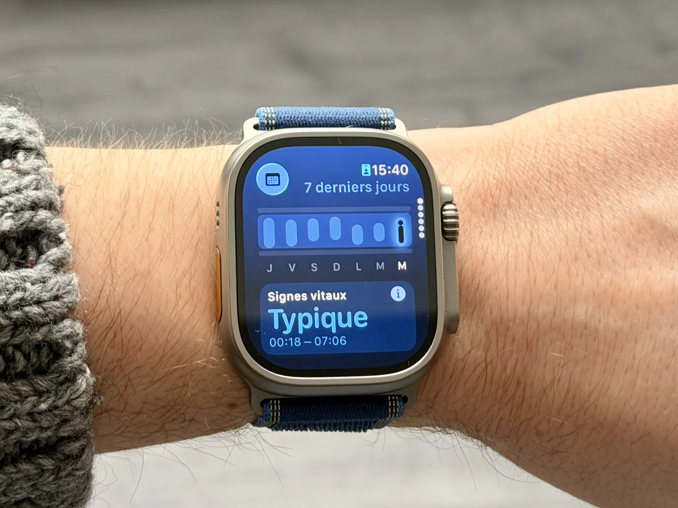 CAPTEUR DE GLYCÉMIE SUR L’APPLE WATCH : UN CHANGEMENT DE DIRECTION ENCOURAGEANT
