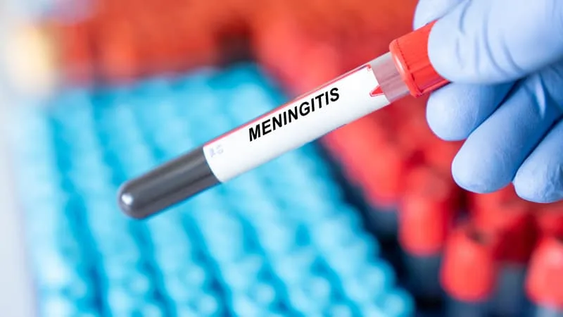 TROIS CAS DE MÉNINGITE, DONT UN MORTEL, SIGNALÉS DANS LE SUD DE L’ANGLETERRE